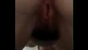 Zoomed in on Stephanies gash