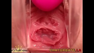 Gynecology Cam Close-Up Vagina Cervix Siswet19 — my chat www.sheer.com/siswet